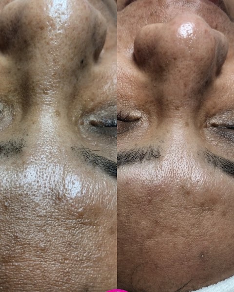 Faceurskin