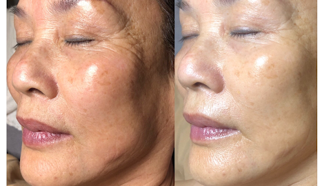 Aura Skin Care