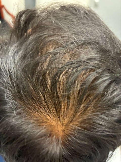 Rani V. Ramachandran M.D - Skin Care Clinic in San Jose