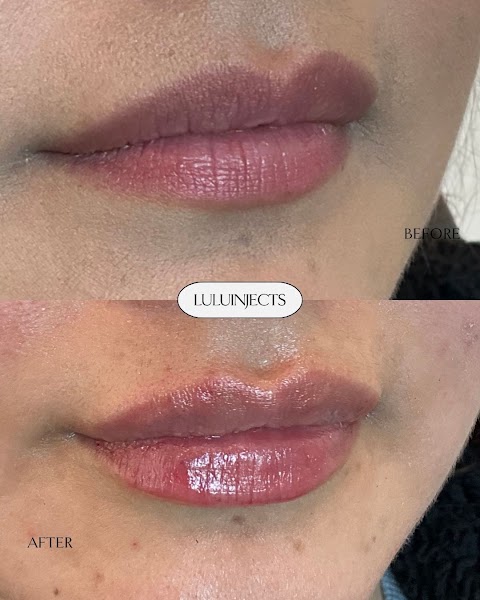 Lulu Ortiz MSN, FNP | Aluma Medical Aesthetics