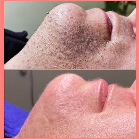 LUX Electrolysis Studio