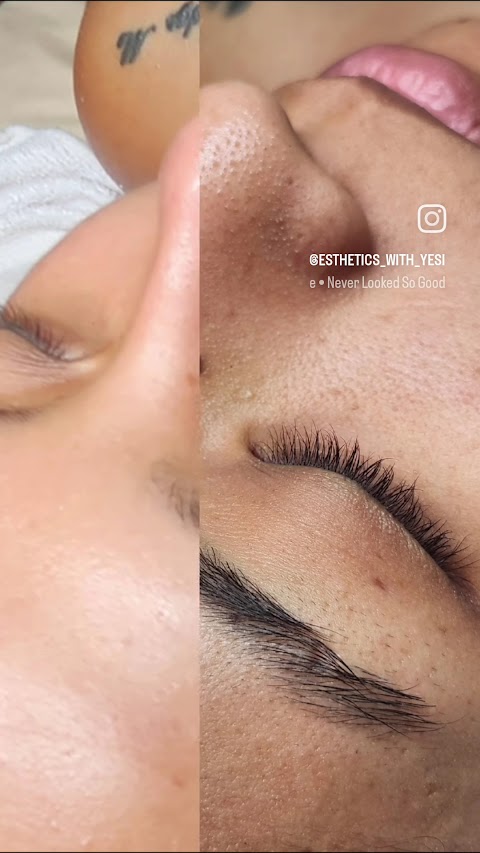 Esthetics With Yesi