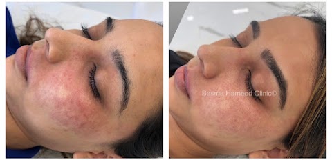 Basma Hameed Clinic Beverly Hills