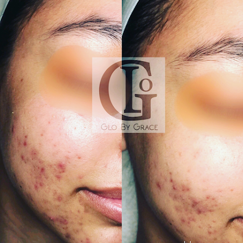 GLO BY GRACE SKINCARE STUDIO