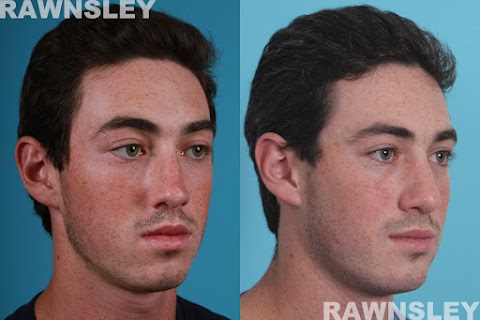 Rawnsley Plastic Surgery