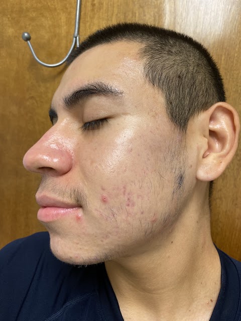 Newd Skin