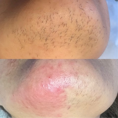 Organic Babe Electrolysis of San Clemente