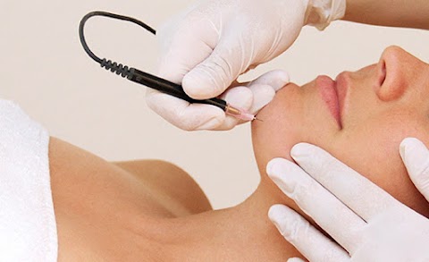 Feeling Fabulous Laser and Electrolysis Hair Removal