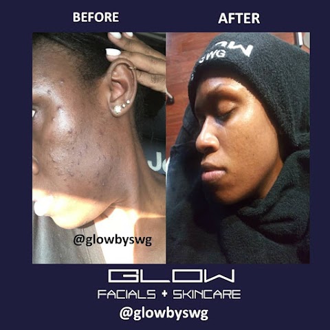 GLOW BY SWG
