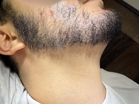 Five Star Laser Hair Removal