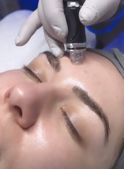 VeLux Laser Hair Removal