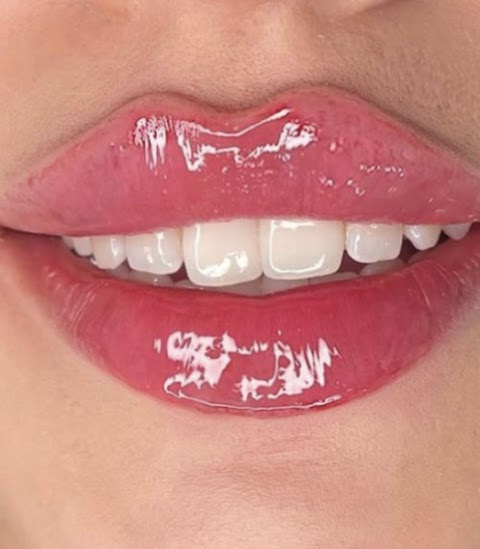 Russian Lip Fillers, medical spa, New York
