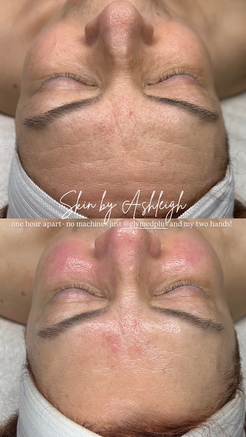 SKIN BY ASHLEIGH