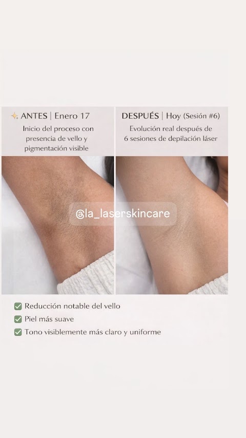 LA Laser & Skincare