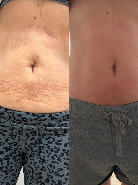Delmar Laser Spa