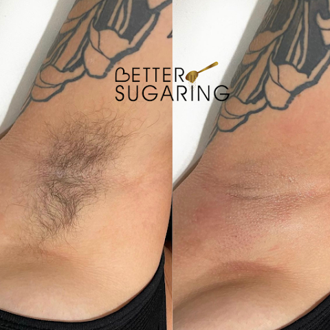 Better Sugaring