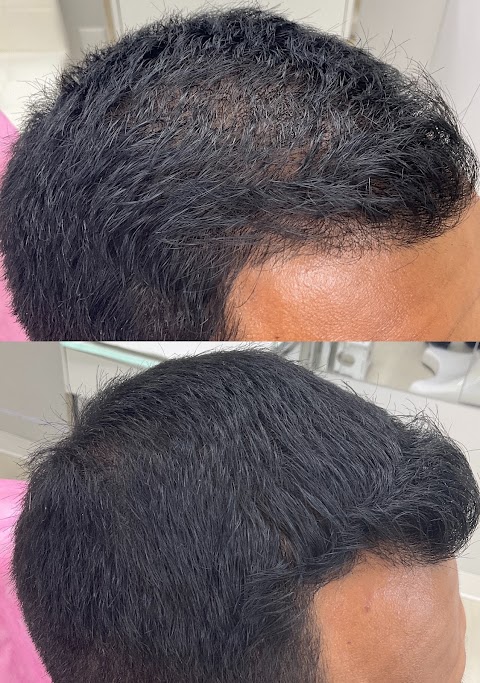 Dermaduo Platelet Rich Plasma & Wellness Clinic - Greenlawn & Smithtown