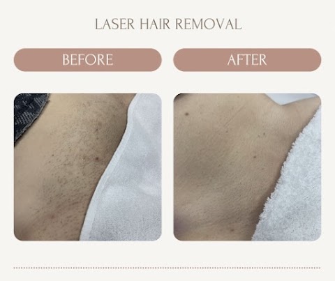 True Glow Laser Spa