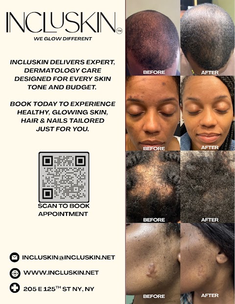 Incluskin Dermatology