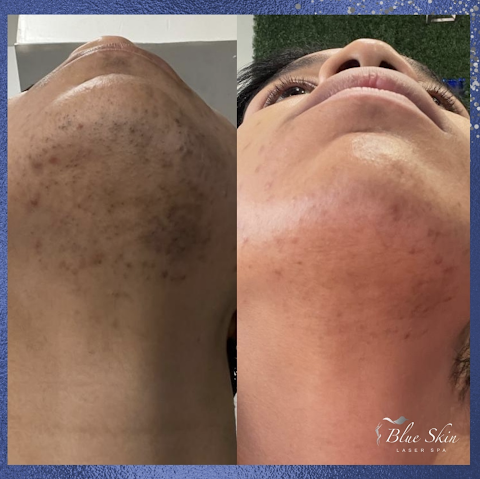 Blue Skin Laser Medspa