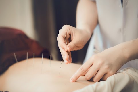 On Acupuncture