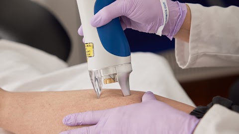 Beauty and the Beas Electrolysis and Laser Hair Removal