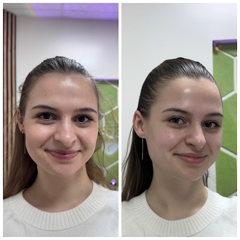 AZ ESSENCE | Face Lifting & Buccal Massage