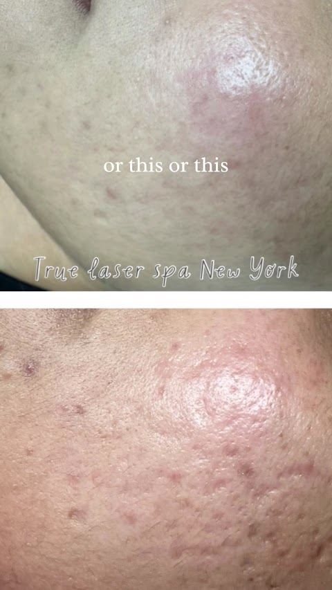 True Laser Spa New York