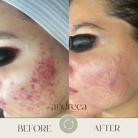 Andreea Skin Studio