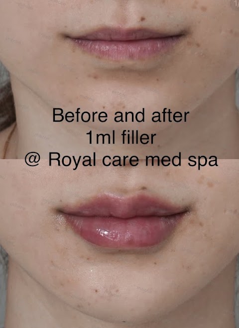 royal care med spa shirley
