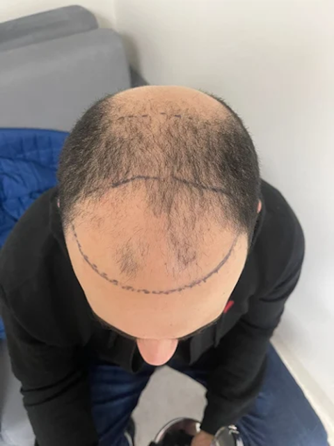 Hairsthetics