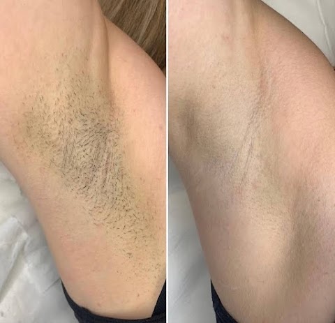 SK Laser Aesthetics
