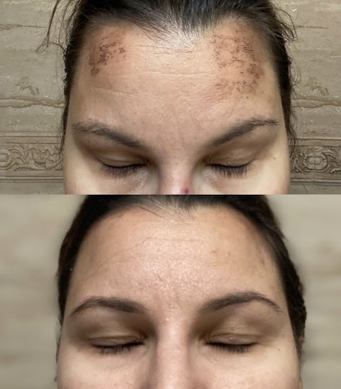Zeta Aesthetics NYC Westchester