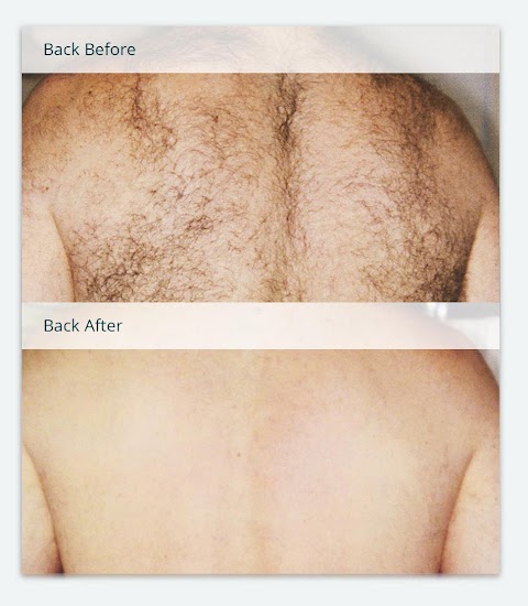 Turning Point Laser Clinic