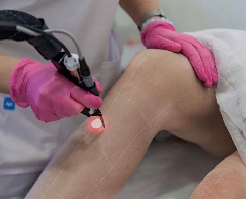 VR Laser Hair Removal