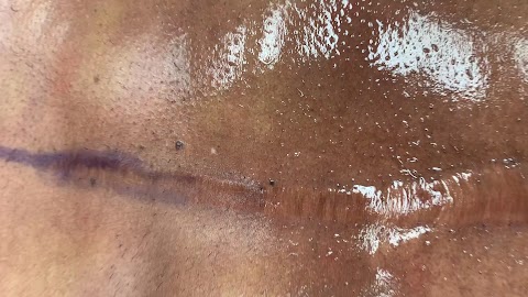 Long Island Gynecomastia Center