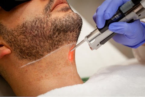 Miss Laser - Laser Hair Removal | Tattoo Removal