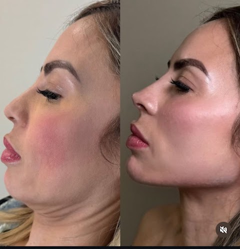 Jen's Beauty | PA Wellness PLLC Medspa
