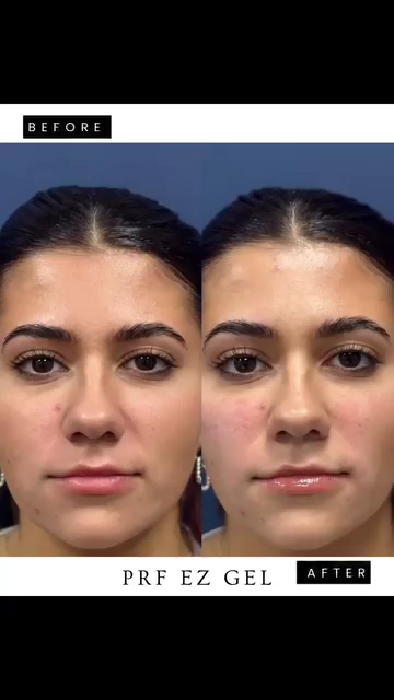 Altman Aesthetic Center Med Spa - Manhattan