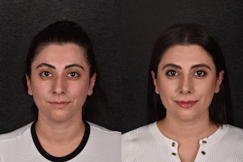 Alemi Facial Plastic Surgery