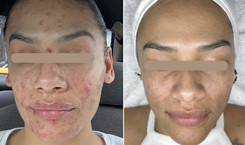 Rios Aesthetics & Wellness
