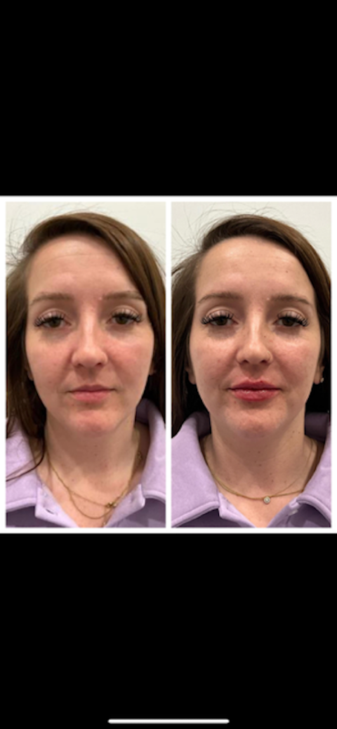 New You Wellness & Esthetics