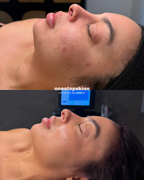 OneStopSkinn