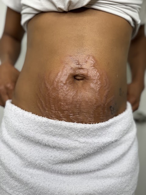 Érica Teixeira | Health & Aesthetic