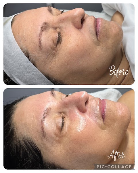 Blush & Glow Esthetiques | Luxury Facials & Body Cavitation for Radiant Skin in Miami, FL