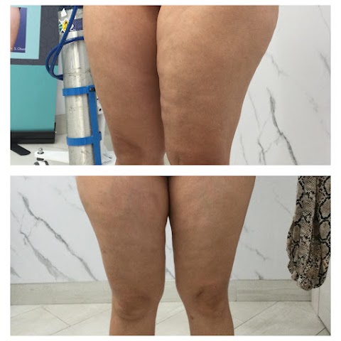 Eye Candy Laser & Wellness Tampa