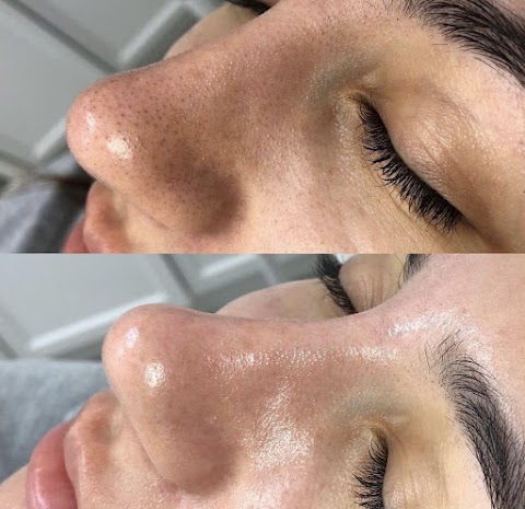 Skin laboratory | Facial & Body Sculpting