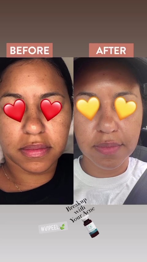 Amazing Skin Care Med Spa