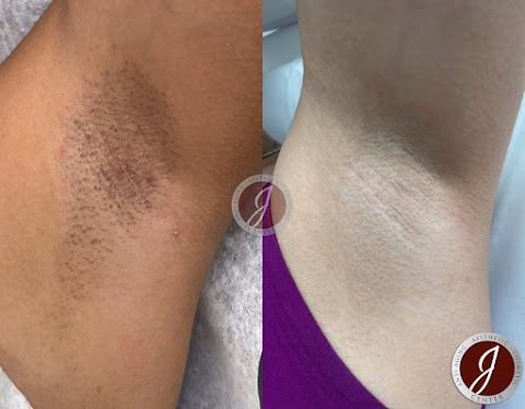 Orlando Laser Hair Removal Spa