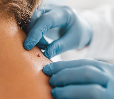 Frieder Dermatology